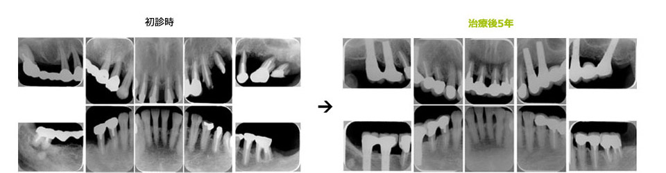 全顎にわたる総合治療