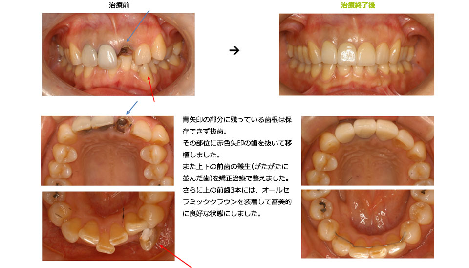 全顎にわたる総合治療