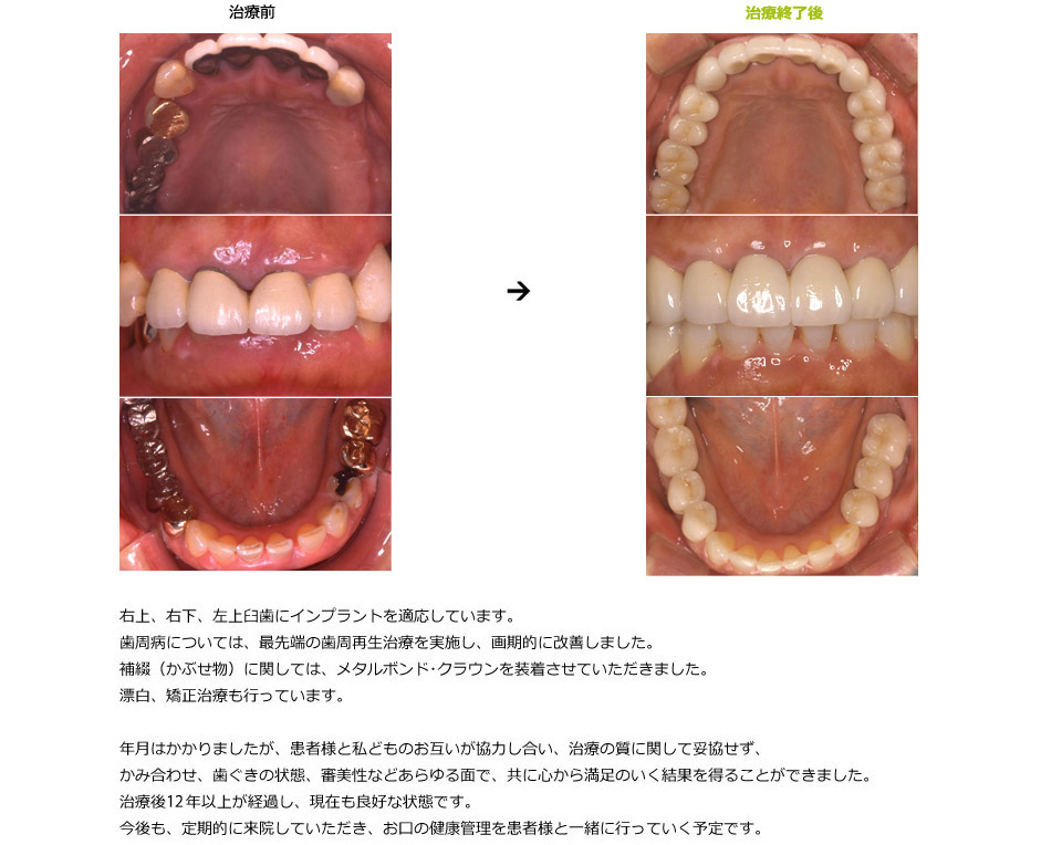 全顎にわたる総合治療