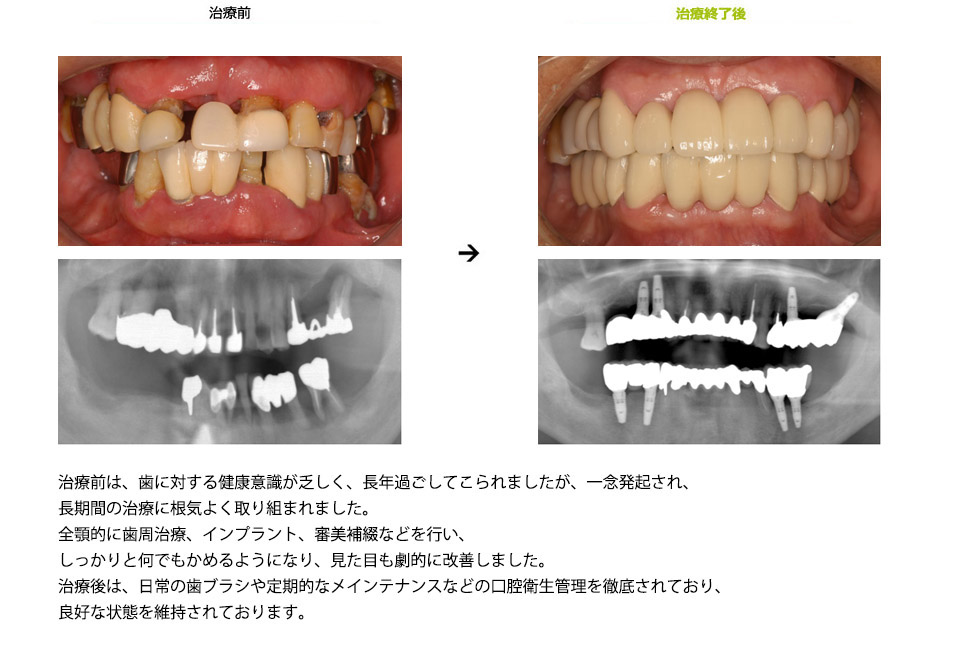 全顎にわたる総合治療