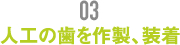 人口の歯を作製、装着